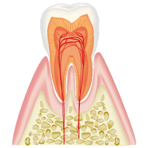 自分の歯を残したい 神経を抜きたくない と思っている方へ 医療法人社団優志会 ヒロ デンタルクリニック