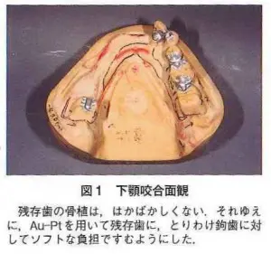 case01