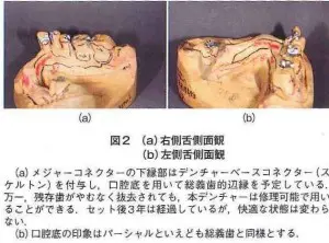 case02