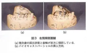 case03