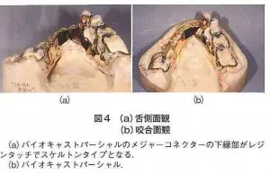 case04