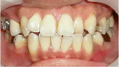case2-1