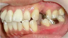 case2-2