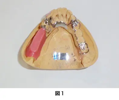gishi-case01