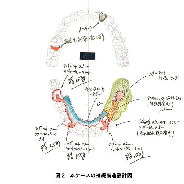 gishi-case02
