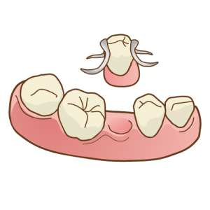 入れ歯